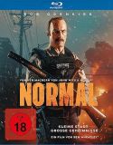 09 normal